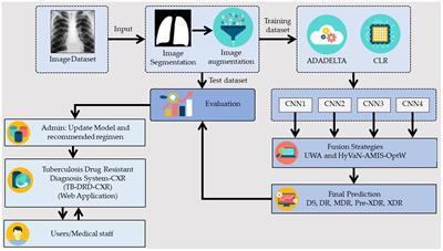Computer-aided diagnosis using embedded ensemble deep learning for multiclass drug-resistant tuberculosis classification